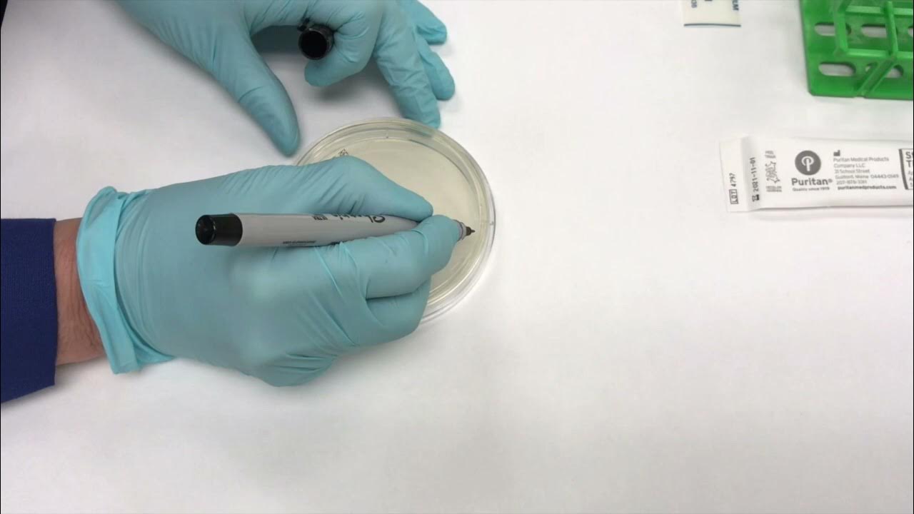 Labeling an Agar Plate YouTube