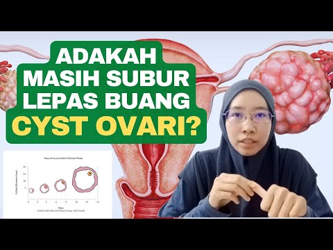 Video: Adakah sista ovari normal?