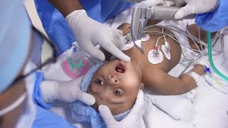 Crying Baby Going into Anesthesia