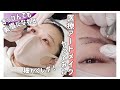 美眉】医療アートメイクしたら、すっぴんに自信がついた！眉毛アートレポ❤️値段/痛み/施術/before after全部見せます！by 桃桃