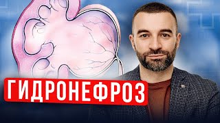 картинка: Гидронефроз у ребенка. Что за болезнь? Как выявить и вылечить?