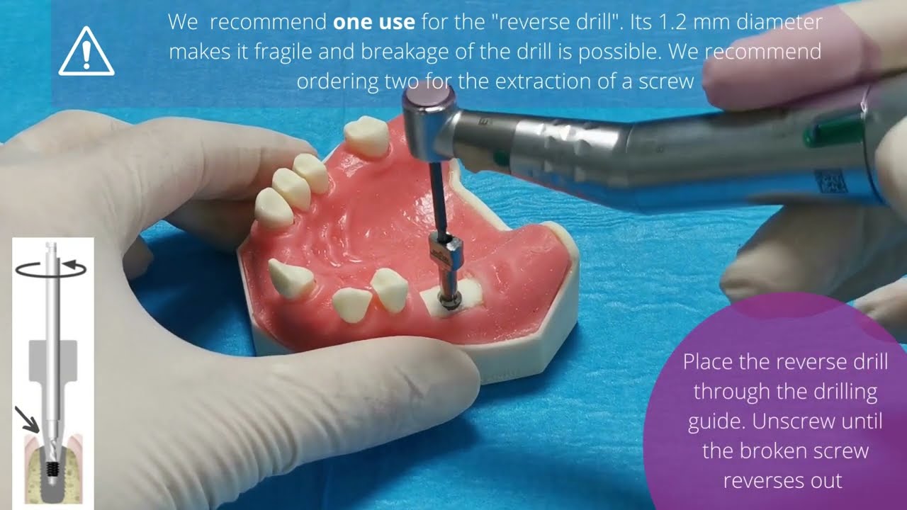 DENTAL TUTORIAL, EXTRACTION KIT, LYRA ETK