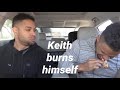 Hodgetwins “Choking” and “Burning” Themselves On Food & Funny Moments