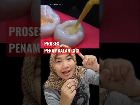 Video: Gigi Bersih Tanpa Anestesia!