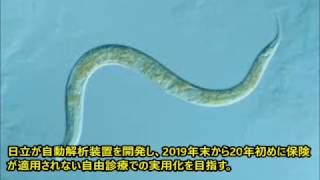 近い将来、線虫と一滴の尿でガンが発見される時代がくる 広東住血線虫 検索動画27 近い将来、線虫と一滴の尿でガンが発見される時代がくる 広東住血線虫 検索動画 27