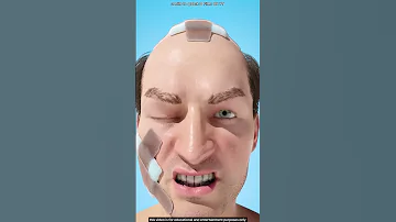 الرجل الذي غي رته ضربة حديدة في رأسه 