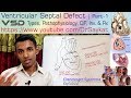 Ventricular Septal Defect (VSD) | Basic Concept explained with Pathophysiology | Dr. Saykat