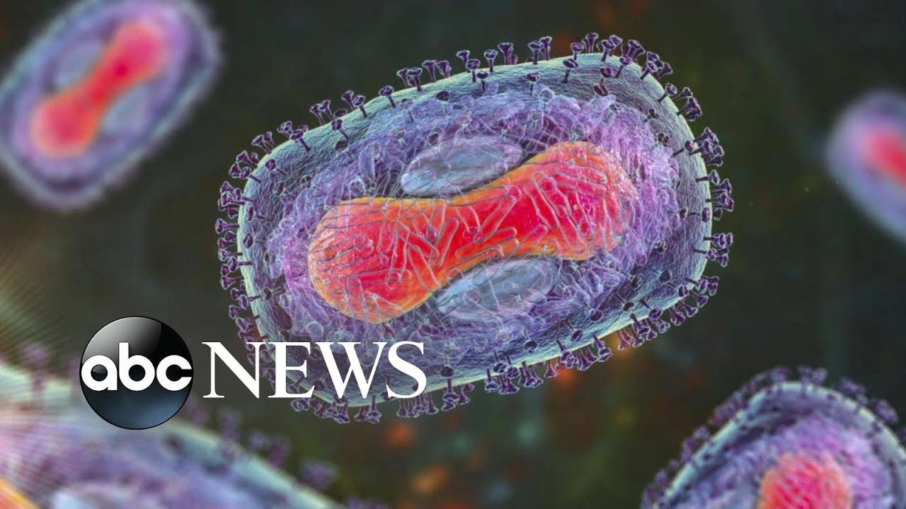 ABC News Live: WHO declares monkeypox 'public health emergency'