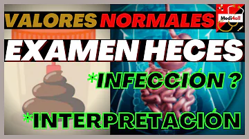 ¿Cómo se comprueba una infección fecal?