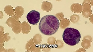 蒙昭良 数据分析师 什么是岭回归和它的作用