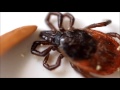 Tick attacks human finger