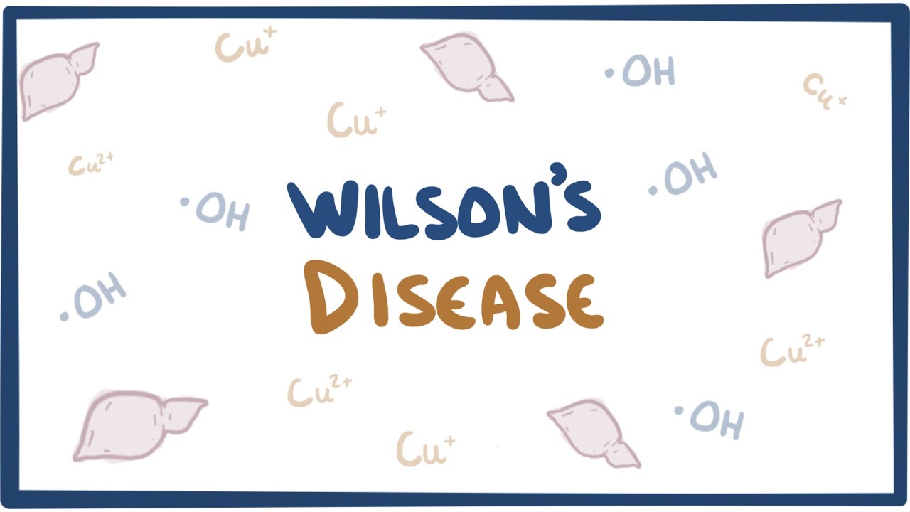 Wilson'S Disease - Causes, Symptoms, Diagnosis, Treatment  Pathology