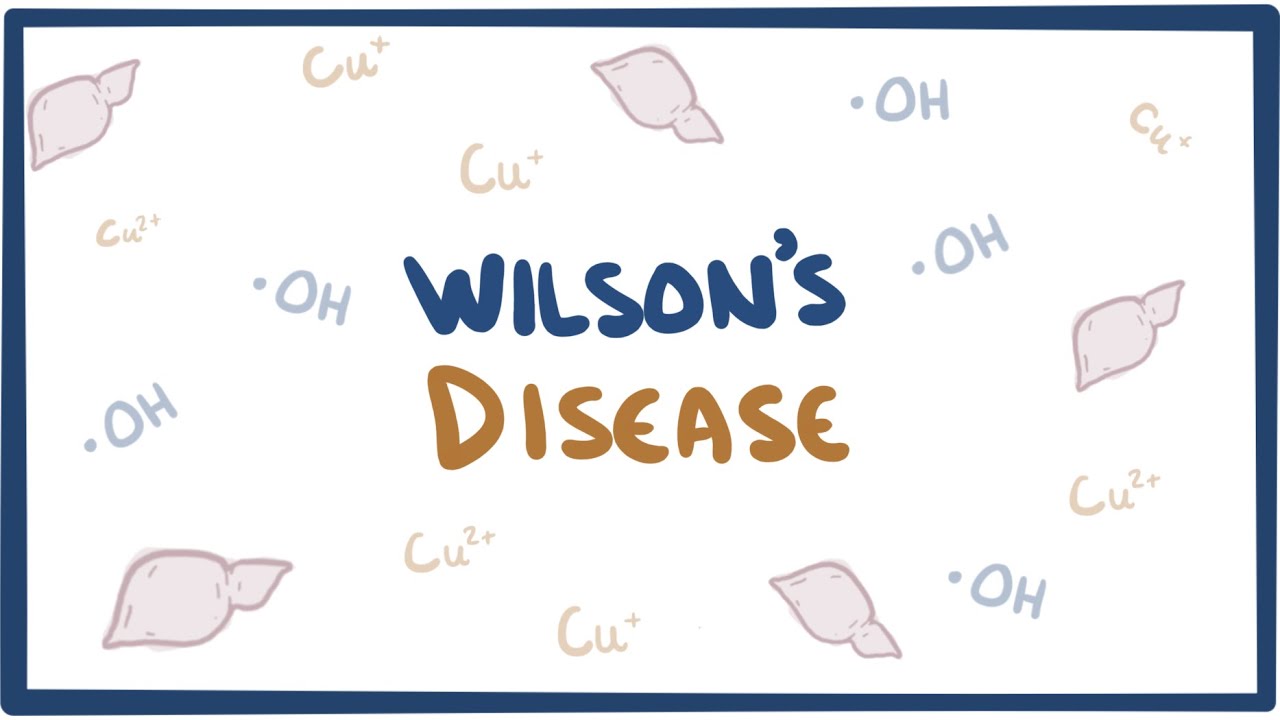 Wilson's disease - causes, symptoms, diagnosis, treatment & pathology