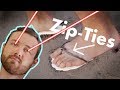 Making Sandals with Zip-Ties and a Laser