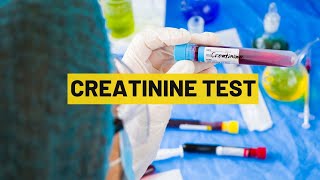 Creatinine Test | My Lab Solution