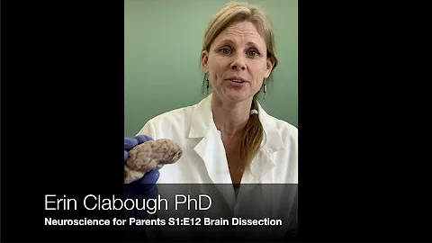 Neuro for Parents S1E12: Brain Dissection