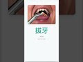 go to dentist vocabulary
