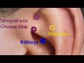 Ear Acupuncture