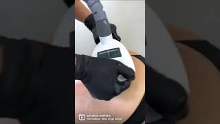 Zemits presents the Bionexis Lite vacuum roller massage and ultrasonic cavitation device 💫