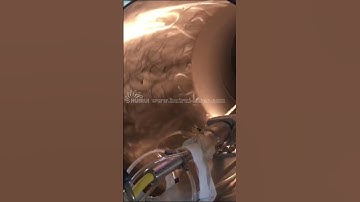 Appreciation of the effect after laser cladding repair #lasercladding #laser#technology #3dprinting