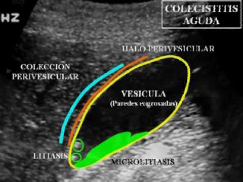 02 Ecografía Hepatobiliopancreática: Fundamentos Básicos