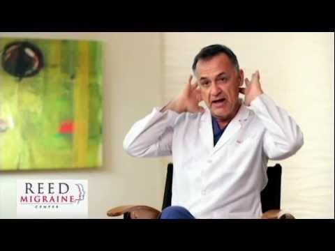occipital-nerve-stimulation-migraine-treatment;-the-trial-implant