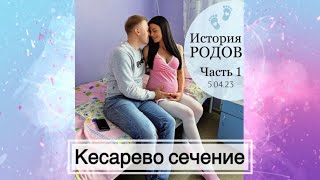 Плановое КЕСАРЕВО СЕЧЕНИЕ ( история родов) часть 1