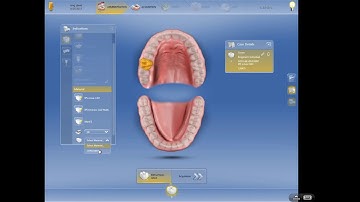 CEREC Dental Assistant Training - Basic Setup for Crown/Bridge