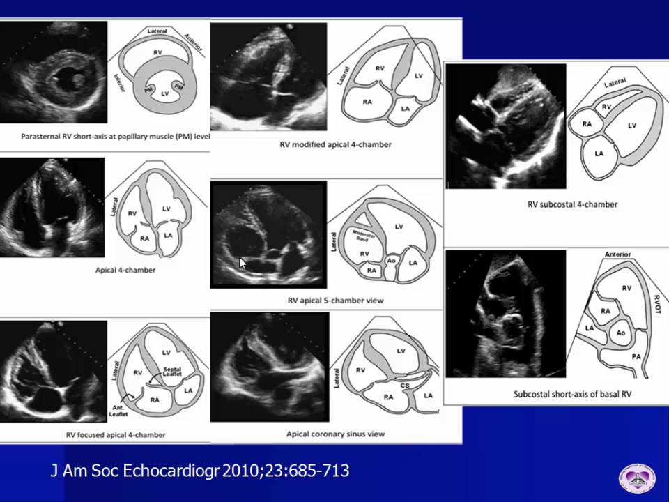 RV Echo Assessment YouTube rv-echo-assessment-youtube