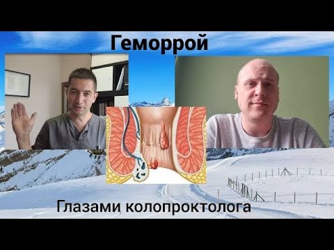 Геморрой. Глазами колопроктолога.