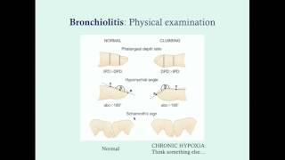 Bronchiolitis - CRASH! Medical Review Series
