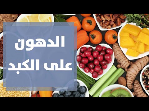 التغذية المناسبة لمرضى دهون على الكبد