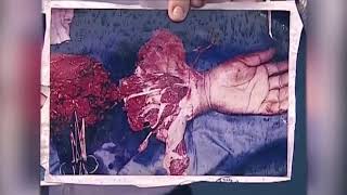 Igreja Mundial do Poder de Deus  - São Luís - MA #brasil #apostolovaldemiro #impdoficial