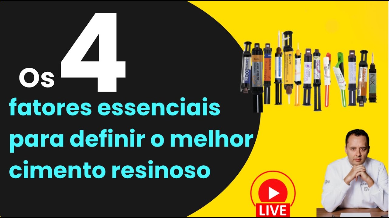 Os 4 fatores essenciais para definir o melhor cimento resinoso
