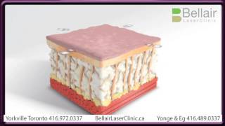 Thermage For Skin Tightening & Anti-Aging