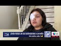 Mujer pierde ojo en ataque por defender a un menor con discapacidad que sufría de 'bullying'