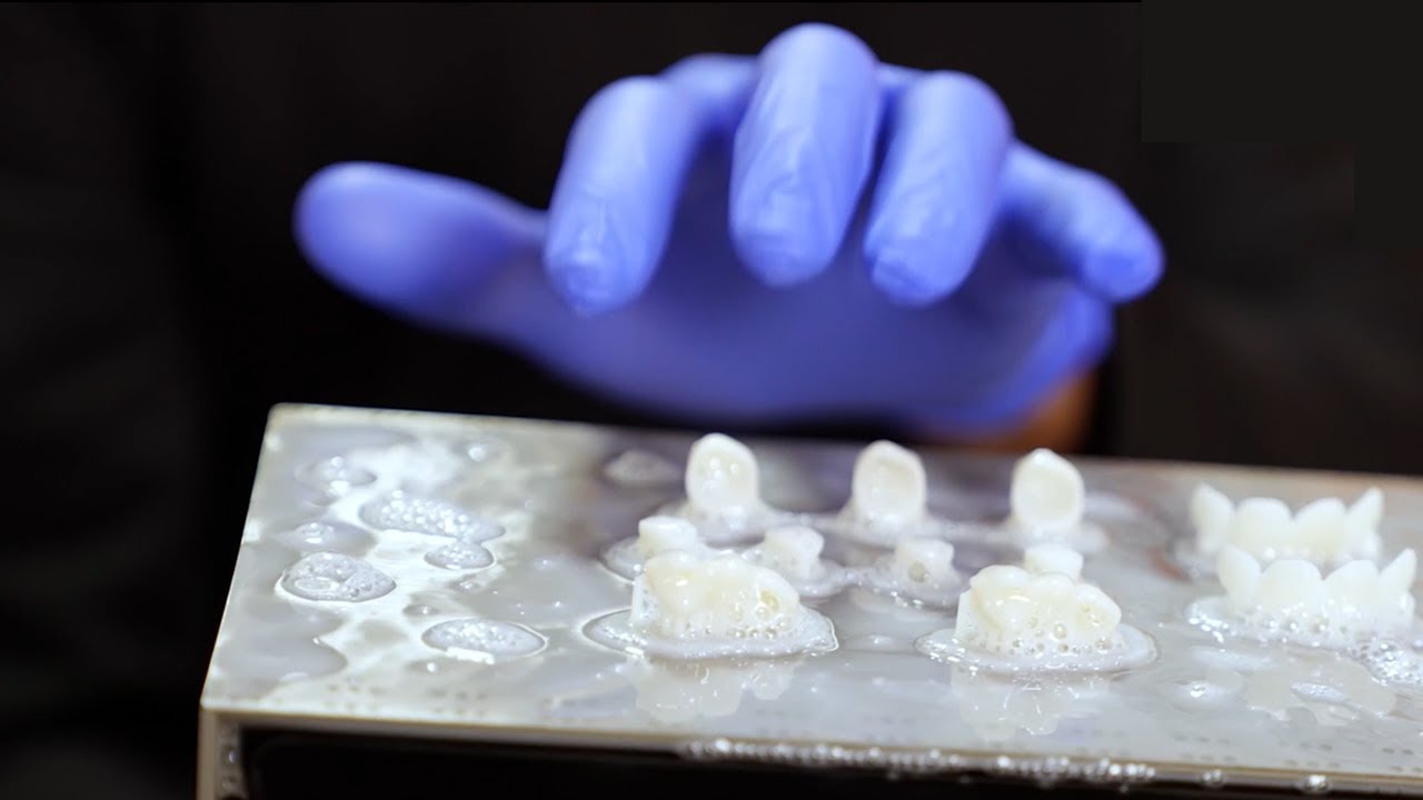 How to design and print restorations with the iTero Design Suite™ | Efficient digital workflow