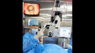Live -Soft cataract "tips and tricks" | Dr Kamal B Kapur