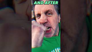 Peter Mcneely Before And After Mike Tyson. Didhe Deserve This Much Damage?