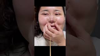 성형붓기 빠지기 전/후 성격 변화  #맥미걸 #위기의아내 #백키로부부 #릴스맛집 #초고도비만 #다이어트 #연애 #부부시트콤