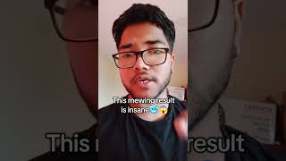 Mewing technique for insane jawline