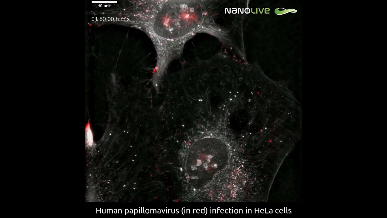 Human papillomavirus infection progression in living HeLa cells