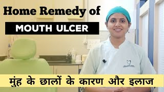 Home remedy of Mouth ulcer l मुंह के छालों के कारण और इलाज