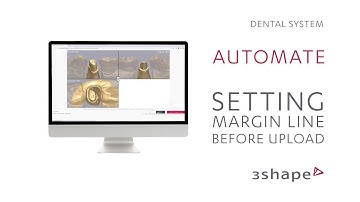 3Shape Automate – Setting the margin before import (German)