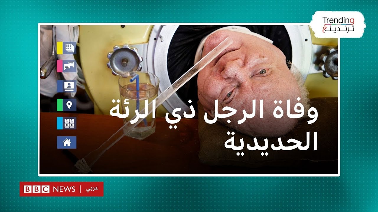 وفاة الرجل ذي الرئة الحديدية بعدما قضى 7 عقود داخل هيكل معدني