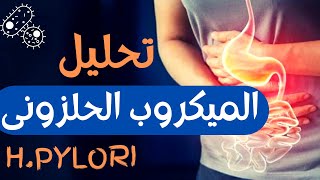 20_ازاي تشتغل تحليل الميكروب الحلزوني (H.Pylori) داخل المعمل بكل سهولة ....