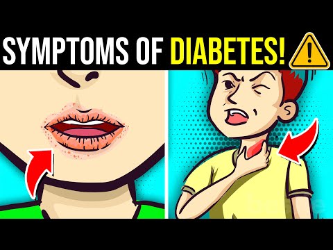 12 Unusual Symptoms Of Diabetes