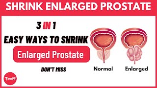 How To Shrink Your Enlarged Prostate Naturally : Every Man Must Know enlargedprostate