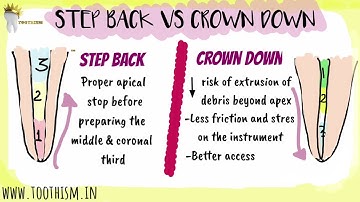 ENDODONTICS | STEP BACK VS CROWN DOWN TECHNIQUE | Biomechanical preparation
