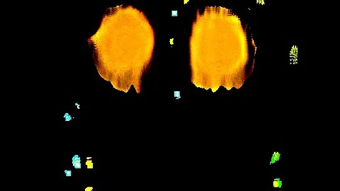 Weird rooms twiddle finger A-40 and A-50